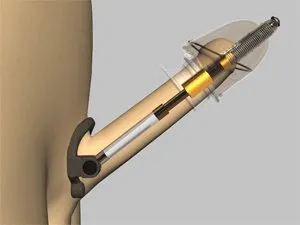 Kinkstasy Male Sex Toys Size Doctor Patented Penis Vacuum Extender